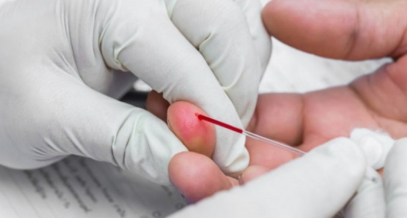 Названа группа крови, обладатели которой защищены от тромбоза 