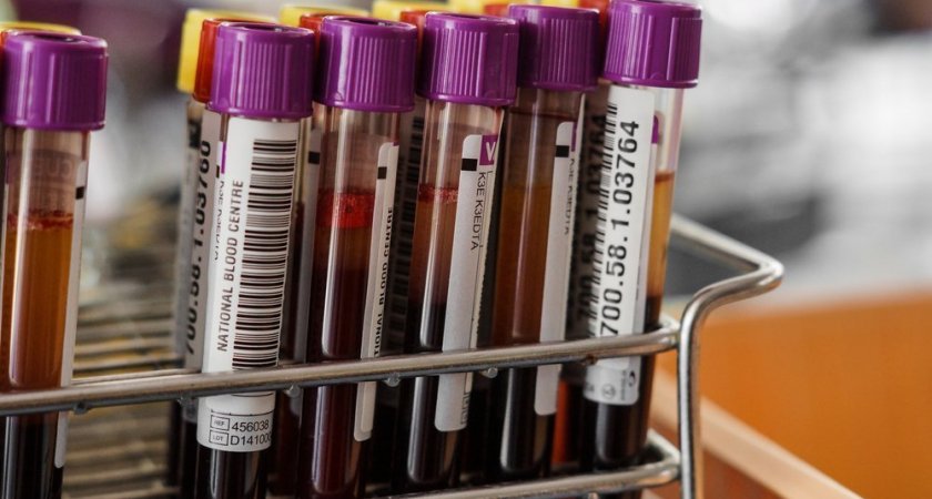 Названа группа крови, носителям которой практически не грозит сердечный приступ 