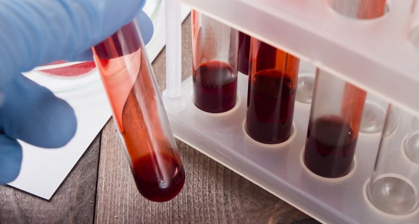 Названа единственная группа крови, носители которой подвержены нервным срывам