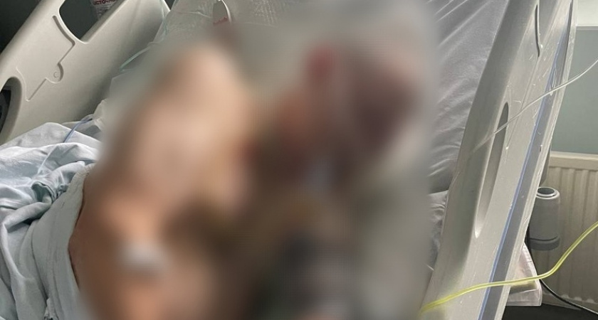 Полиция Саранска выясняет личность мужчины, которого нашли на улице Попова без сознания