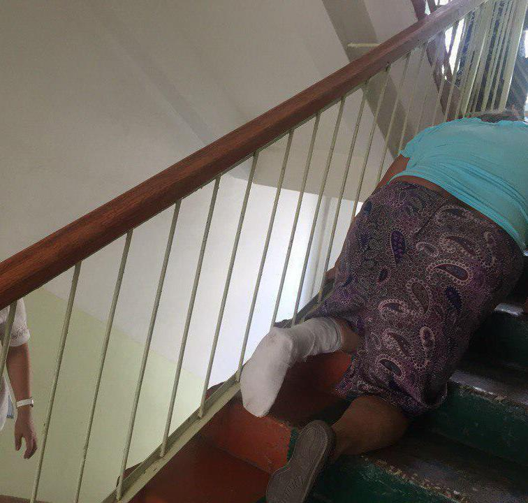 В Мордовии пенсионерке со сломанной ногой пришлось ползти по лестнице в больнице на третий этаж