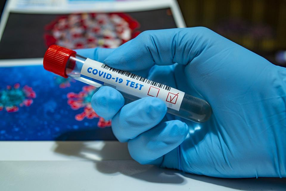 В Мордовии еще 30 человек заразились коронавирусом