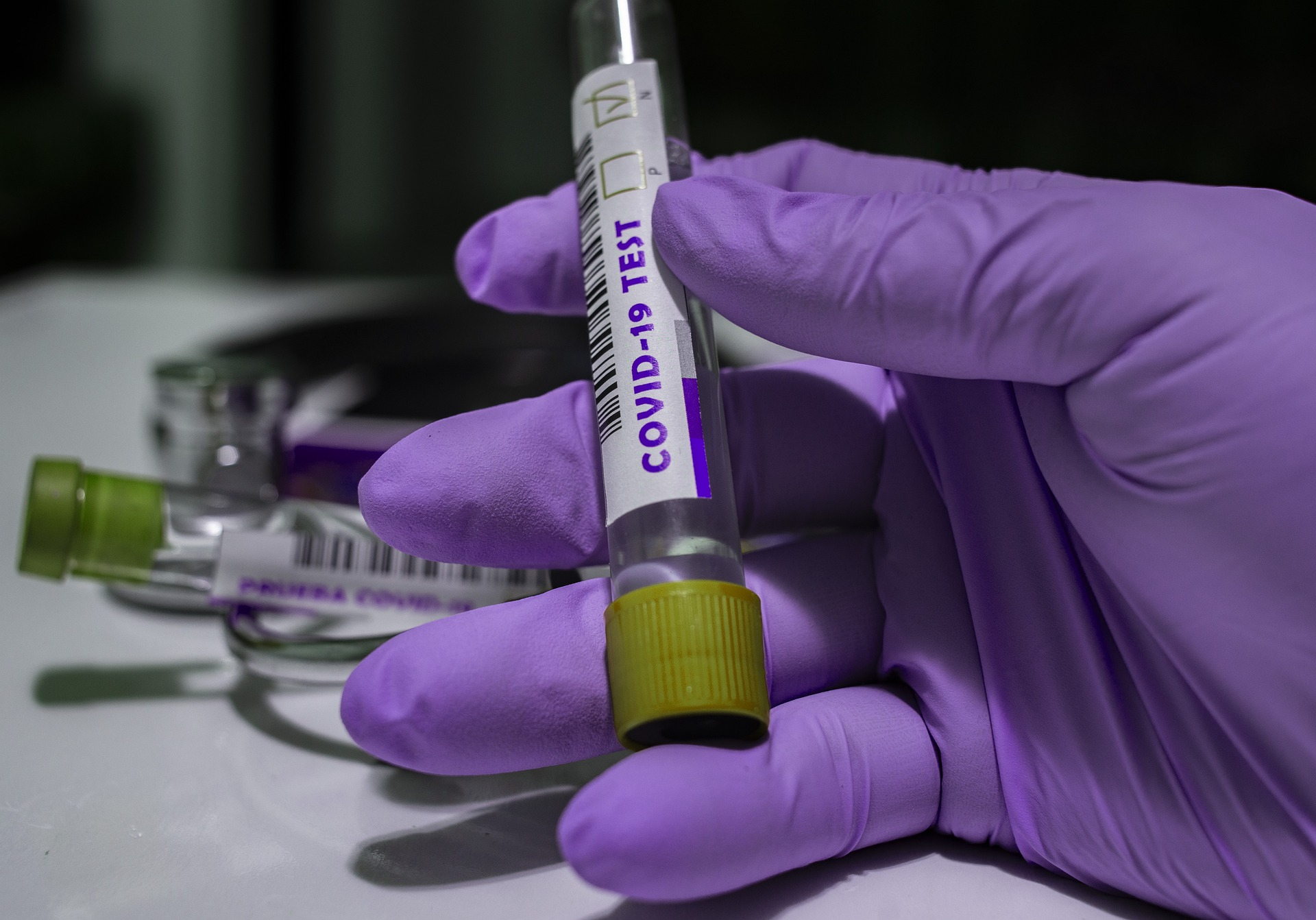 За сутки в Мордовии подтвердили коронавирус у 35 человек