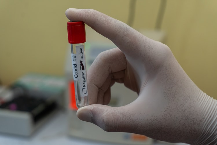 Еще 32 новых случая коронавируса зарегистрировано в Мордовии
