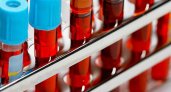 «Грозят серьезные проблемы»: Ученые назвали самую уязвимую группу крови 