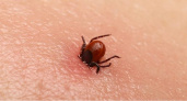 В Мордовии клещи покусали 226 человек