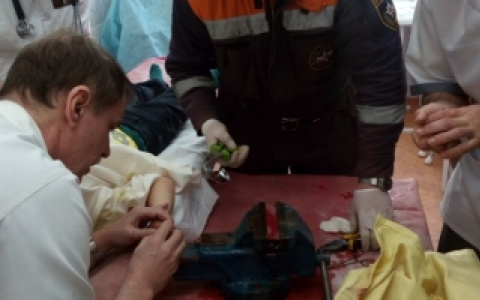 В Саранске четырехлетний ребенок едва не остался без пальца