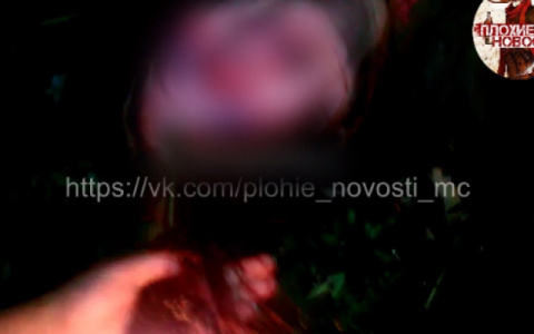 В Прикамье школьники избили сверстницу и подожгли ей волосы