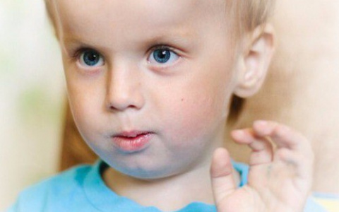 Стало известно, когда «мраморному» мальчику из Саранска сделают операцию 