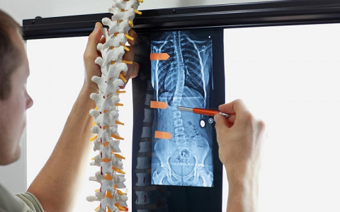 Лечение сколиоза может быть малоинвазивным