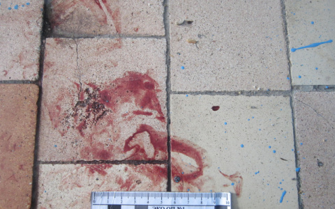 «Попросил выпить»: в одном из общежитий Саранска мужчине сломали пять ребер и нос