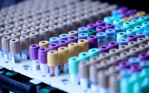 Оперштаб: За сутки в Мордовии выявлен 81 новый случай COVID-19