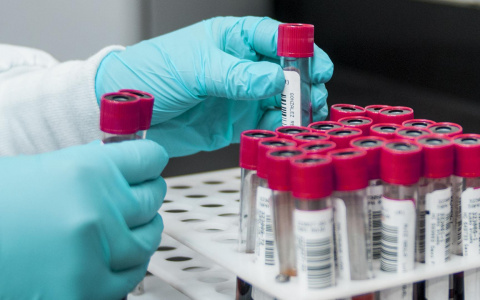 35-летний житель Саранска, заразивший женщину ВИЧ-инфекцией, получил условный срок